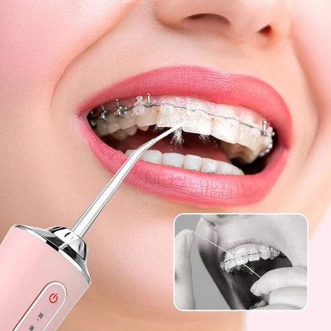 Professional Oral Irrigator for Teeth